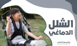 الشلل الدماغي