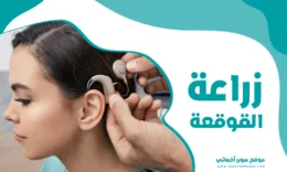 زراعة القوقعة